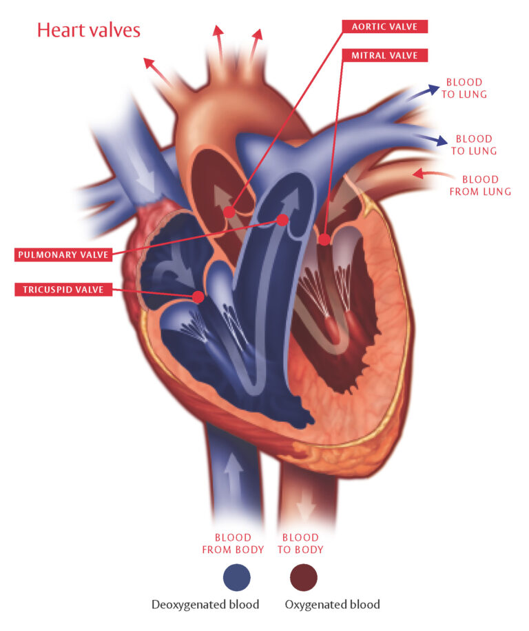 heart-murmur-heart-valve-disease-leading-tavi-team-in-mumbai-the